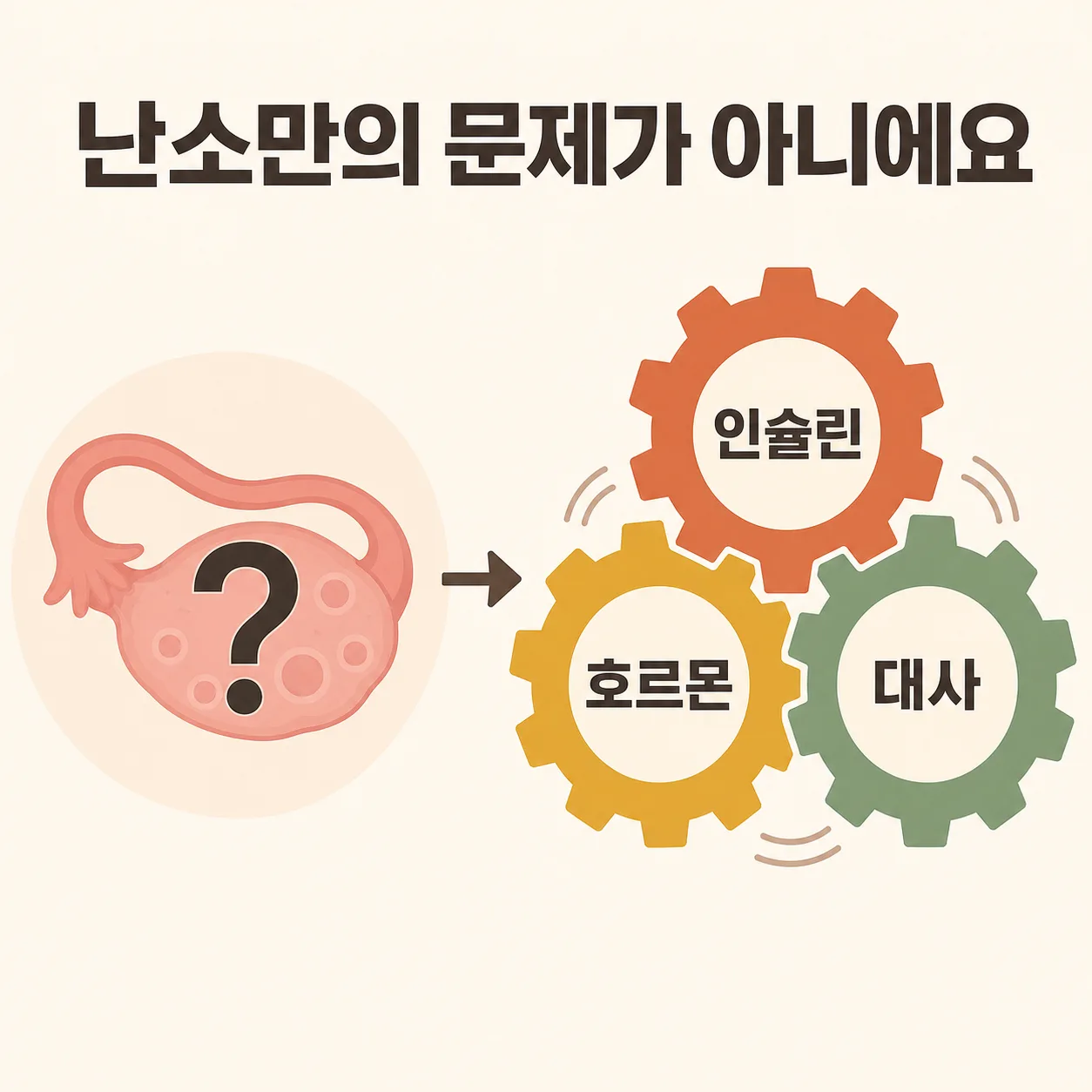 다낭성난소증후군은 난소만의 문제가 아니다